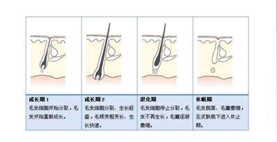 為什么有時(shí)候感覺家用脫毛儀效果不明顯？(圖1)