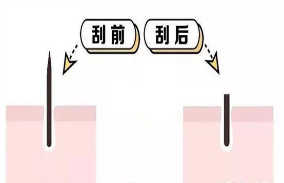 脫毛不徹底，毛毛的生命力到底有多頑強？(圖3)